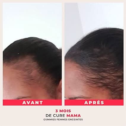 Gummies for Pregnant and Breastfeeding Women | MAMA