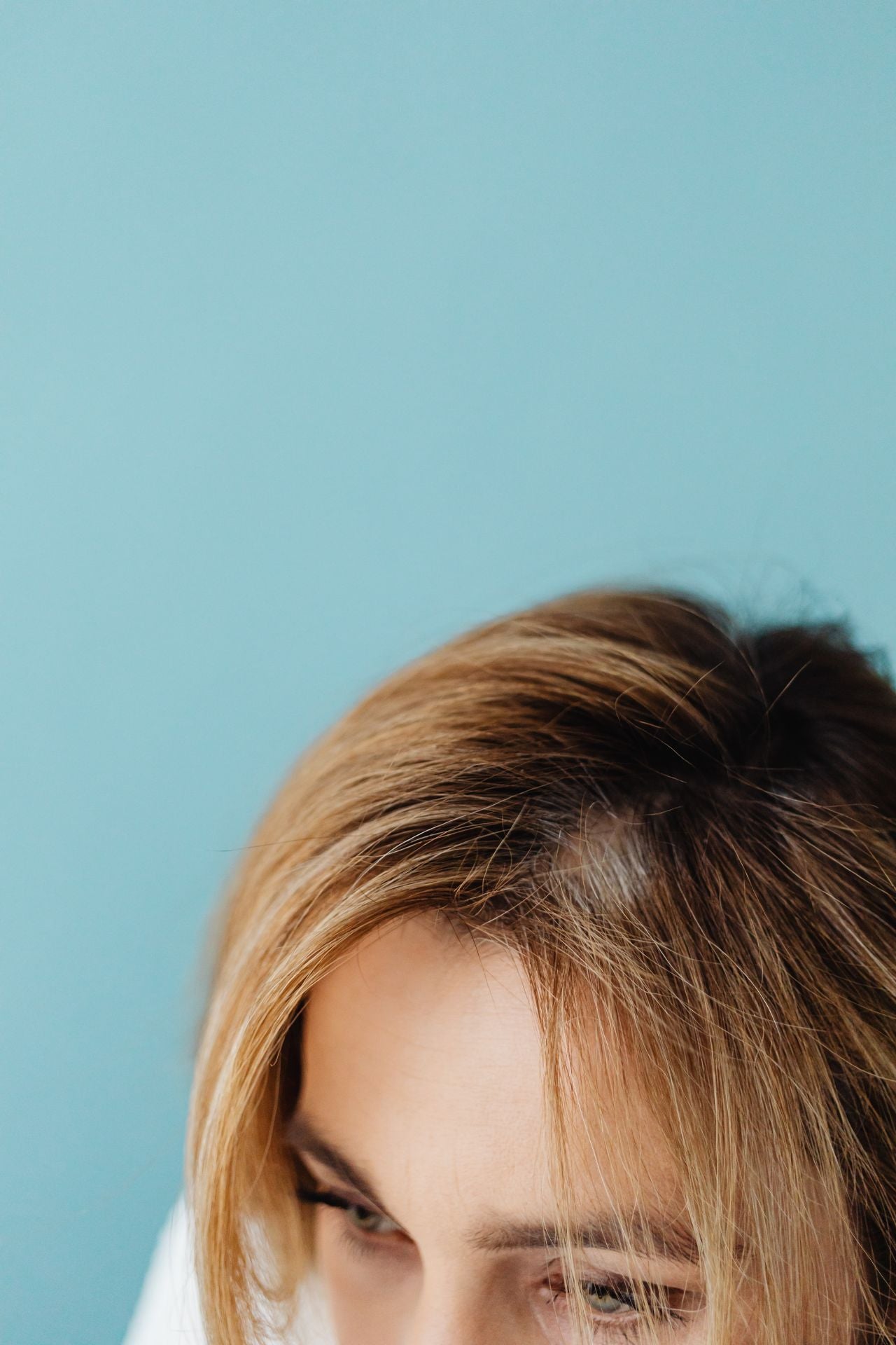 SOPK et cheveux : éclaircissement de la raie chez la femme